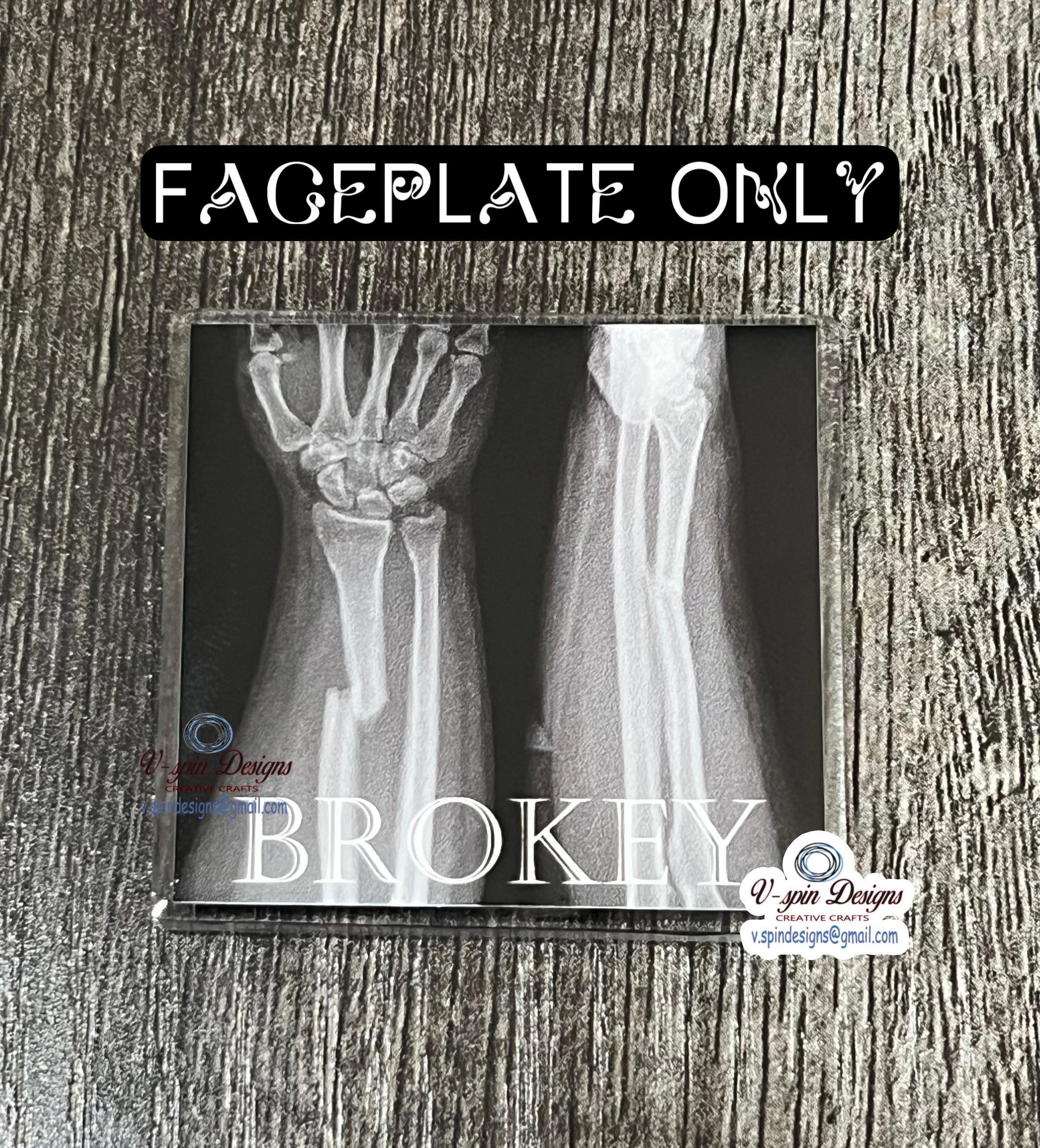 Brokey X-Ray Badge Reel: Funny Retractable ID Holder